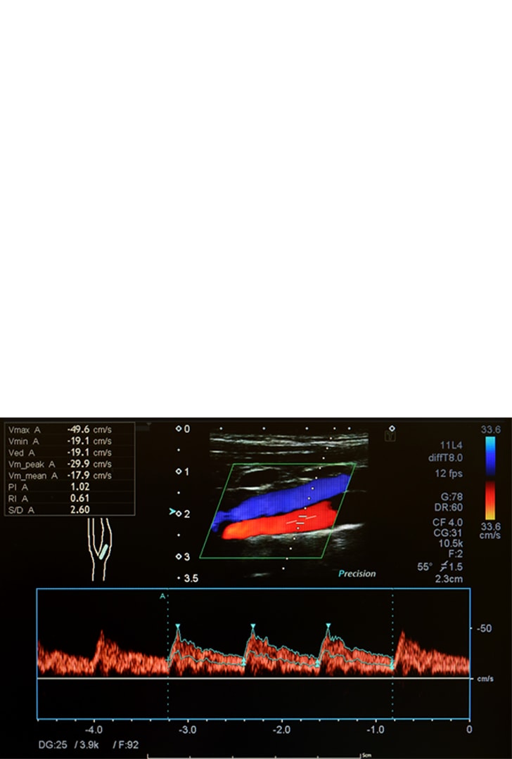 31” 12MP IPS Diagnostic Monitor for Mammography | 31HN713D-B 31” 12MP IPS Diagnostic Monitor for Mammography | 31HN713D-B