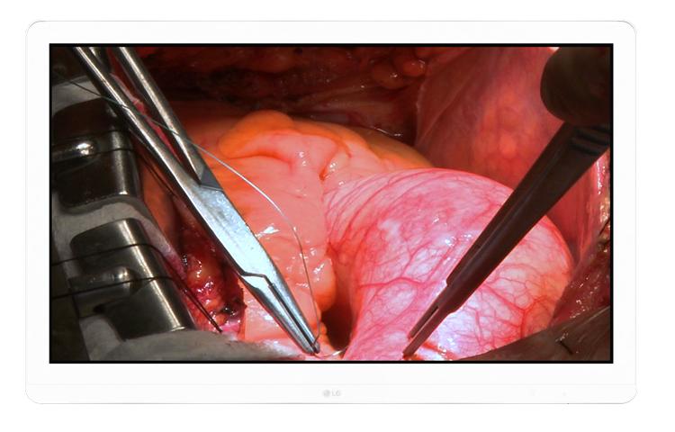 FDA Class II 8MP Surgical Monitor1