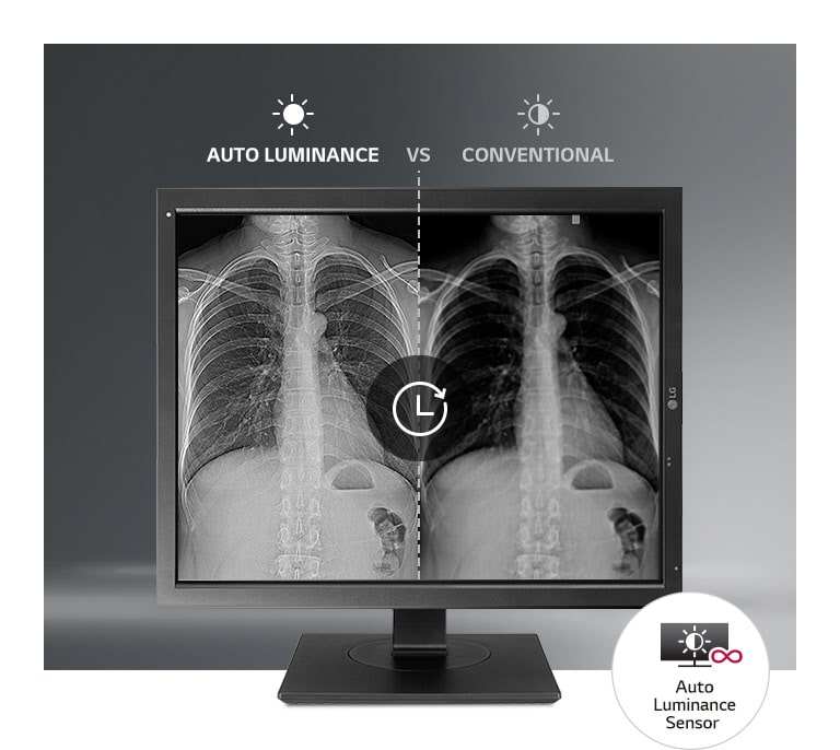 21.3” High Brightness (2048 x 1536) 3MP Color IPS Diagnostic Monitor