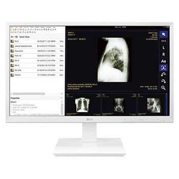 24” All-in-One FHD IPS Thin Client for Medical & Healthcare with Fanless & ergonomic design1