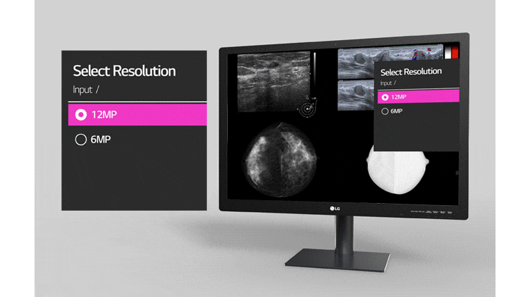 31” 12MP IPS Diagnostic Monitor for Mammography | 31HN713D-B 31” 12MP IPS Diagnostic Monitor for Mammography | 31HN713D-B