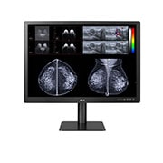 LG 31” 12MP (4200x2800) IPS Diagnostic Monitor for Mammography with Multi-resolution Modes, Pathology Mode, Self-calibration, Focus View, PBP and Dual Controller, front view with image, 31HN713D-B, thumbnail 1