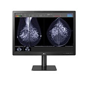 LG 31” 12MP (4200x2800) IPS Diagnostic Monitor for Mammography with Multi-resolution Modes, Pathology Mode, Self-calibration, Focus View, PBP and Dual Controller, front view with image two, 31HN713D-B, thumbnail 2
