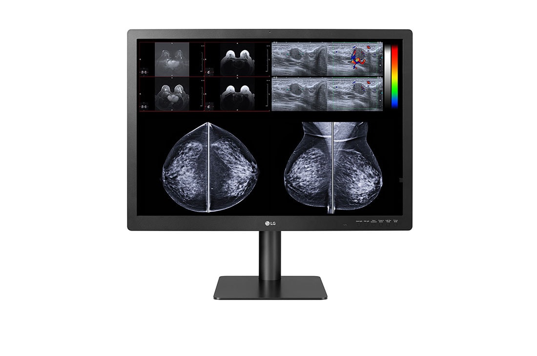 LG 31” 12MP (4200x2800) IPS Diagnostic Monitor for Mammography with Multi-resolution Modes, Pathology Mode, Self-calibration, Focus View, PBP and Dual Controller, front view with image, 31HN713D-B