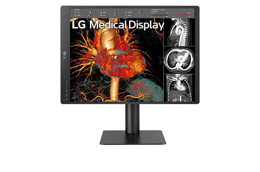LG 21.3” 3MP IPS Diagnostic Monitor with Ergonomic Design, Daisy Chain, and Front Sensor Calibration, 21.3” 3MP IPS Diagnostic Monitor front view with infill horizontal position, 21HQ513D-S, thumbnail 2