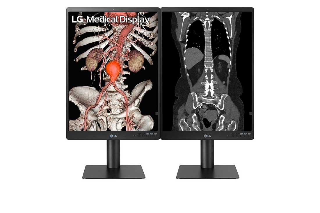LG 21.3” 3MP IPS Diagnostic Monitor with Ergonomic Design, Daisy Chain, and Front Sensor Calibration, 21.3” 3MP IPS Diagnostic Monitors side-by-side vertical position, 21HQ513D-S, thumbnail 11