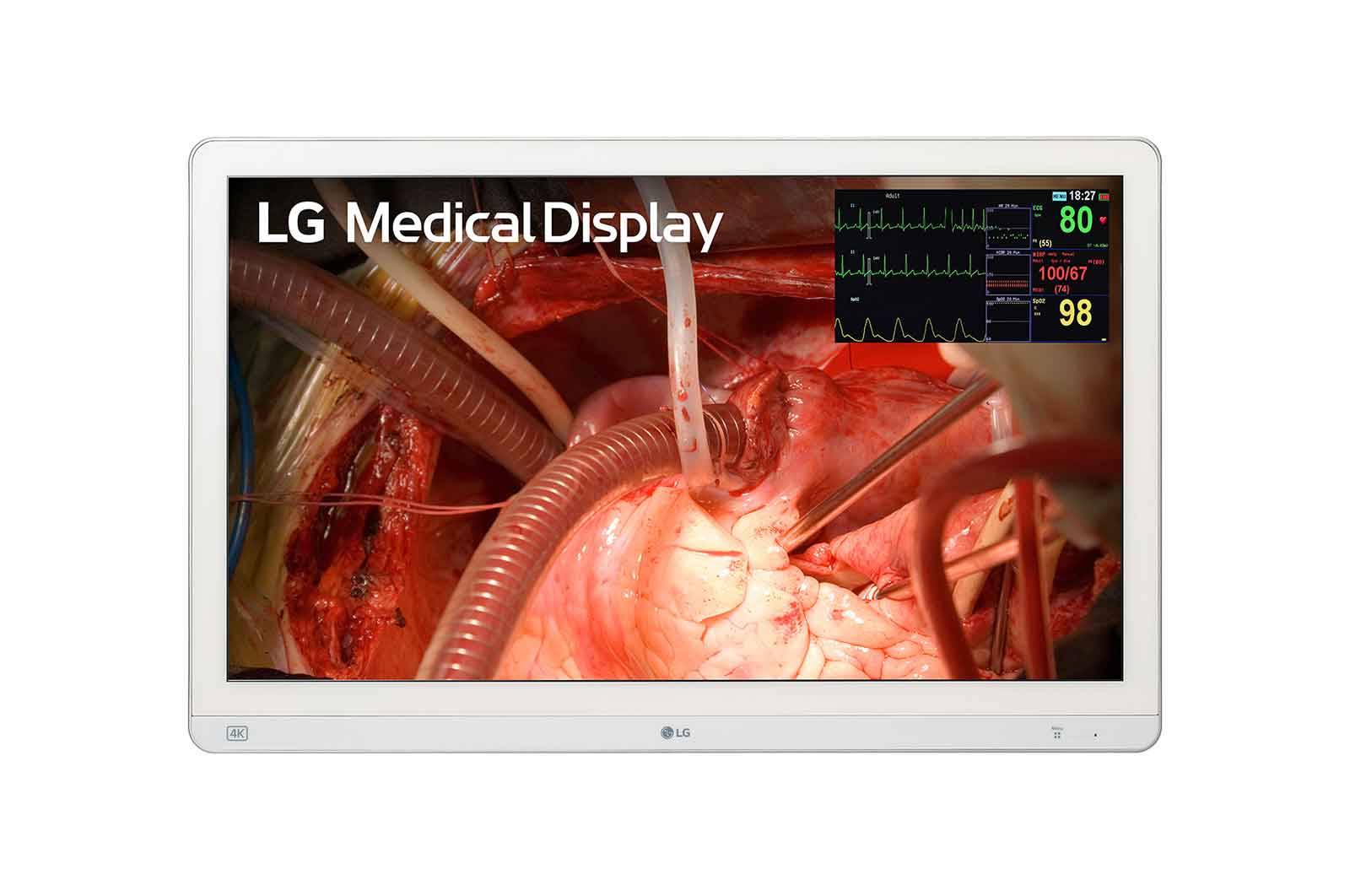 LG 27HQ710SW 27inch 4K Surgical Monitor with MiniLED LG USA Business