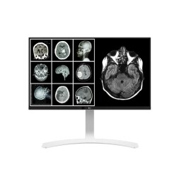 8MP Clinical Review Monitor2