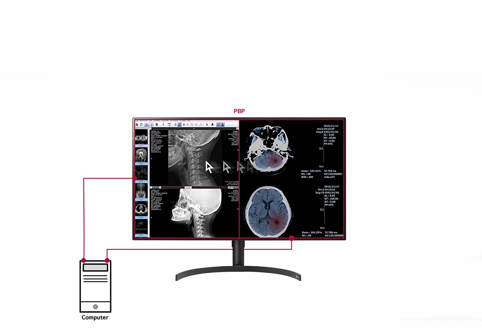 31.5” 8MP Color Diagnostic Monitor LG US Business